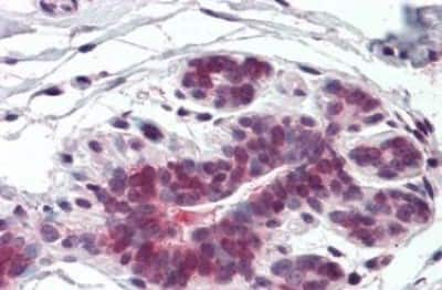 Immunohistochemistry-Paraffin: ELOVL5 Antibody [NBP3-14305] - ELOVL5 antibody IHC of human breast. Immunohistochemistry of formalin-fixed, paraffin-embedded tissue after heat-induced antigen retrieval.